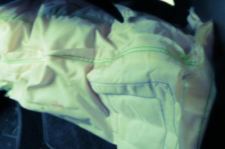 Bloc ABS (freins anti-blocage) TOYOTA AURIS 1